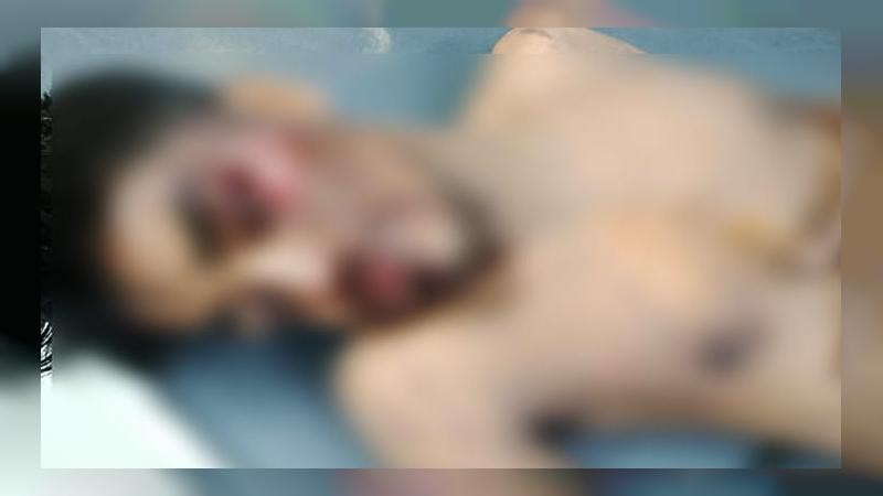চট্টগ্রামের শাহ আমানত সেতু এলাকায় ছিনতাইয়ের অভিযোগে গণপিটুনির শিকার যুবক হাসপাতালে ভর্তি