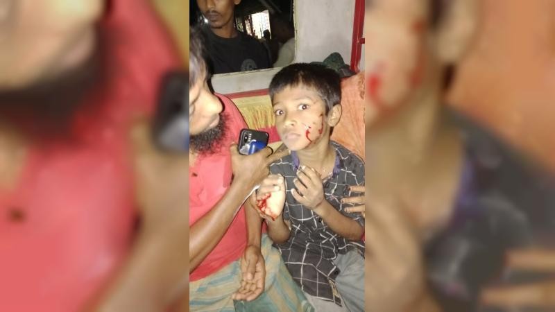 শিয়ালের কামড়ে শিশুসহ ৮ জন আহত, মুরাদনগরে আতঙ্ক
