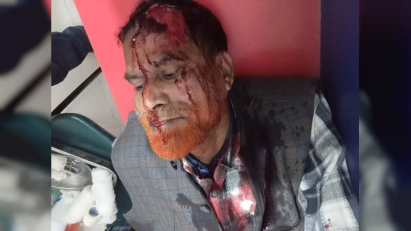 শাহজাদপুরে পরিবহন ব্যবসা নিয়ে সংঘর্ষ, বিএনপি নেতাসহ আহত ১০