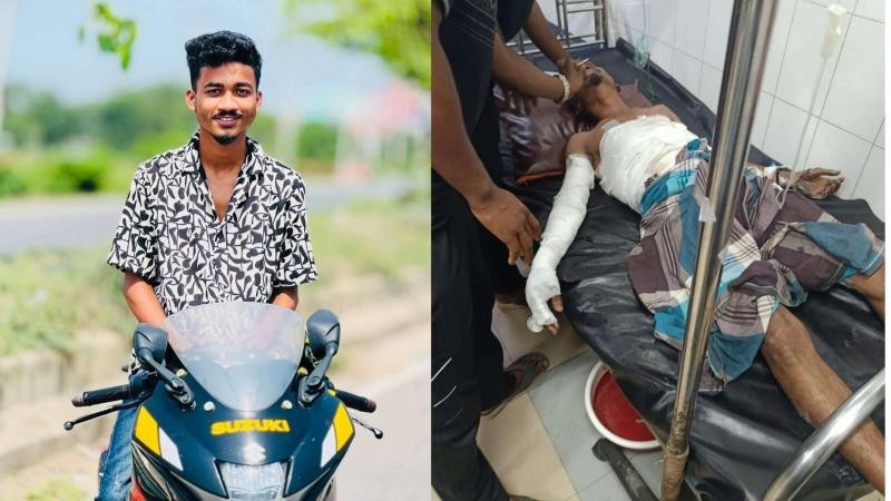 অকটেন ভাগাভাগি নিয়ে সংঘর্ষ: প্লাস্টিক কারখানায় অগ্নিকাণ্ডে দগ্ধ হয়ে যুবকের মৃত্যু