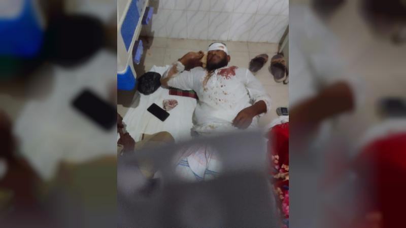 নাটোরে ক্রিকেট খেলাকে কেন্দ্র করে সংঘর্ষ, আহত ১২