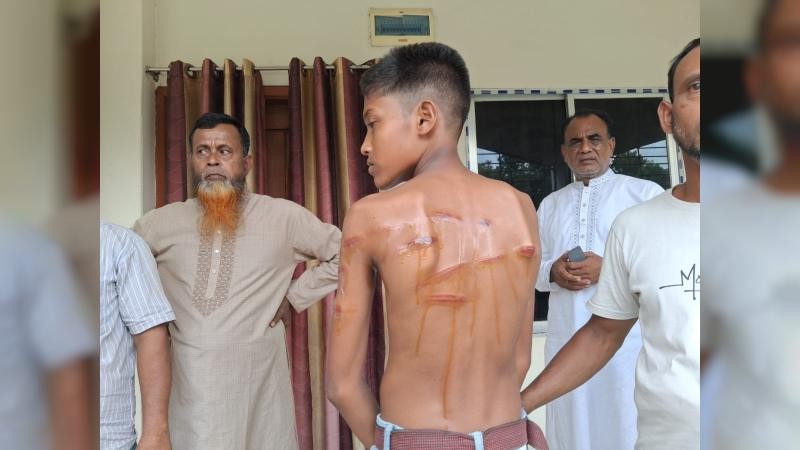 বাগদুলী উচ্চ বিদ্যালয়ের শিক্ষকের বেত্রাঘাতে হসপিটালে ছাত্র, শিক্ষক অবরুদ্ধ