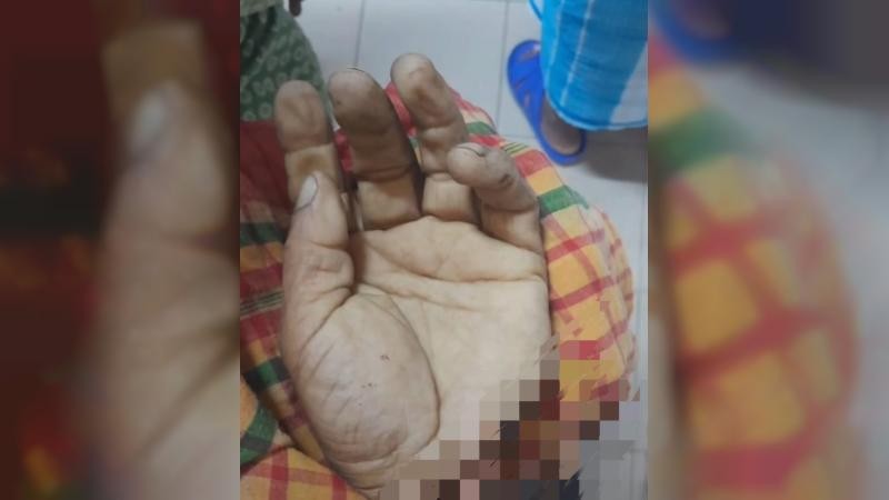 নগরকান্দায় হাতের কব্জি কেটে নেওয়ার ঘটনায় গ্রেফতার ২