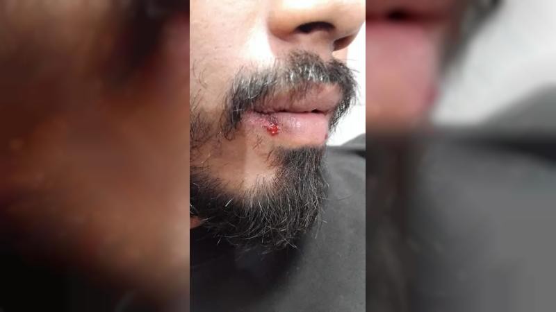 ইবিতে বাসে কথা কাটাকাটি থেকে সংঘর্ষ, আহত ৬