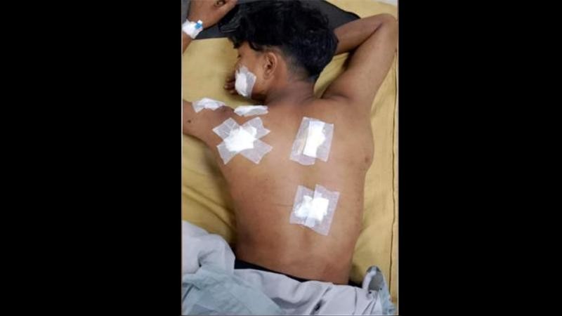 শেরপুরে কেল্লাপোষী মেলায় যুবককে ছুরিকাঘাত, অবস্থা আশঙ্কাজনক
