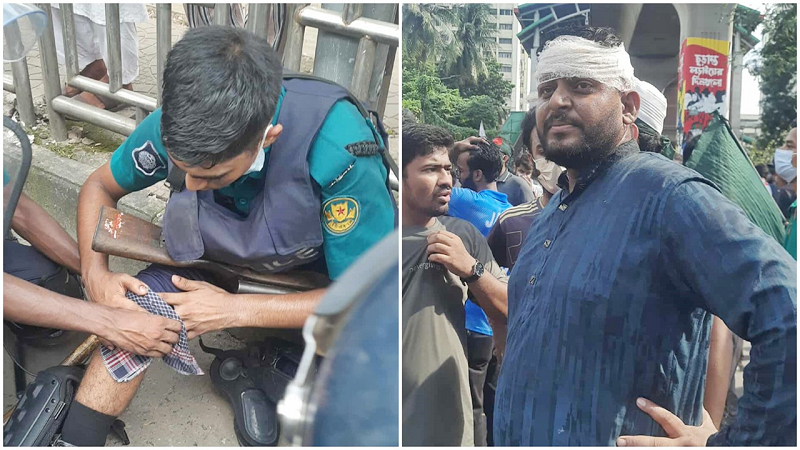 পুলিশ-শিক্ষার্থীদের মধ্যে ধাওয়া-পাল্টা ধাওয়ায় রণক্ষেত্রে শাহবাগ, আহত ১০