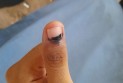 রাকসু নির্বাচন : আঙুলের কালি মুছে যাওয়ার অভিযোগ
