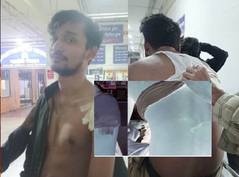 রাজশাহী বিশ্ববিদ্যালয়ের সেই ফারাবীসহ ৩ জনকে পিটিয়ে আহত