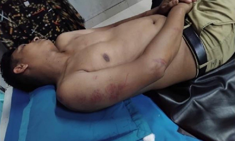 আশুলিয়ায় ইন্টারনেট ব্যবসাকে কেন্দ্র করে হামলা, আহত ৩