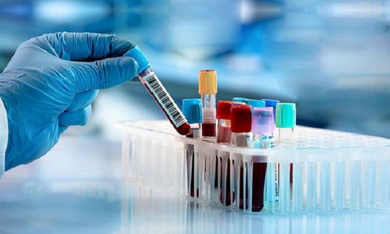 সব ধরনের চাকরিতেই লাগবে ডোপ টেস্ট