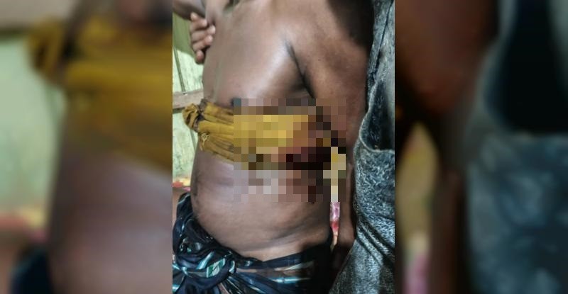 তাহিরপুরে পূর্ববিরোধের জেরে ৬ জনকে কুপিয়ে আহত, ২ জন আইসিইউতে