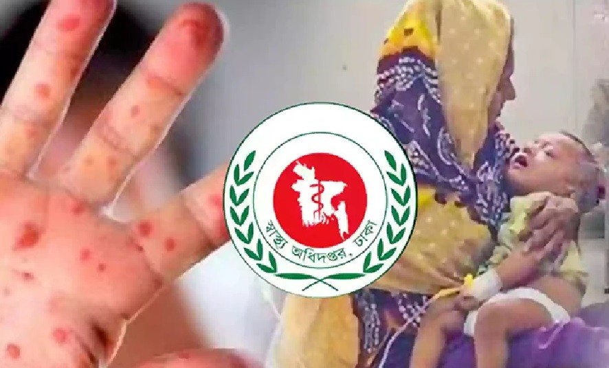 10 More Children Die from Measles and Its Symptoms